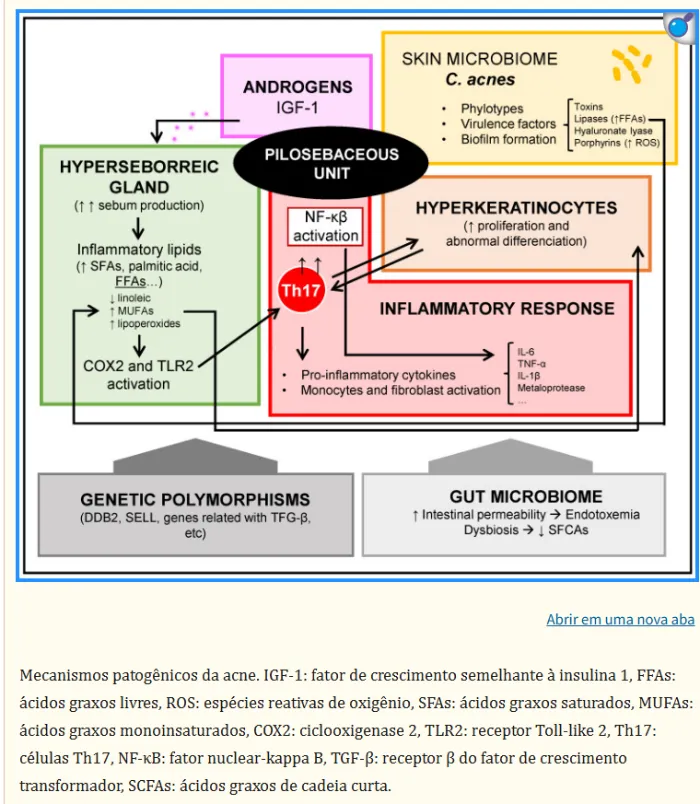 Mecanismos patogênicos da acne
